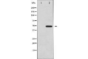 Western blot analysis of Vitamin D Receptor expression in Jurkat whole cell lysates,The lane on the left is treated with the antigen-specific peptide. (Vitamin D Receptor anticorps  (Internal Region))