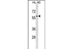 Western blot analysis in HL-60 cell line lysates (35ug/lane). (TFAP2D anticorps  (C-Term))