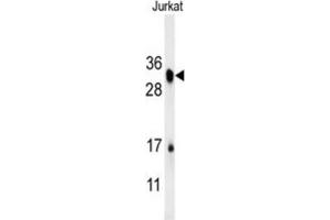 Western Blotting (WB) image for anti-R-Spondin 4 (RSPO4) antibody (ABIN3002419) (R-Spondin 4 anticorps)