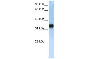 WB Suggested Anti-ZCCHC17 Antibody Titration:  0. (ZCCHC17 anticorps  (C-Term))