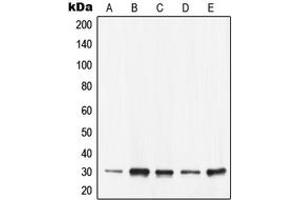 Western blot analysis of 14-3-3 epsilon expression in KNRK (A), SW480 (B), Caco2 (C), NIH3T3 (D), H9C2 (E) whole cell lysates. (YWHAE anticorps  (C-Term))