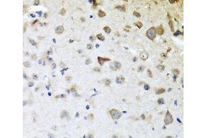 Immunohistochemistry of paraffin-embedded Mouse brain using CPA6 Polyclonal Antibody at dilution of 1:100 (40x lens).