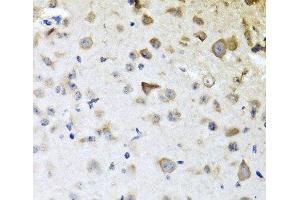 Immunohistochemistry of paraffin-embedded Mouse brain using CPA6 Polyclonal Antibody at dilution of 1:100 (40x lens). (CPA6 anticorps)