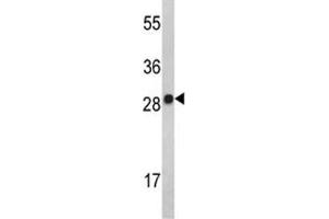 Western blot analysis of IL-2 antibody and MDA-MB231 lysate. (IL-2 anticorps  (AA 50-77))