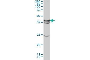 MAPK3 monoclonal antibody (M01), clone 3C9 Western Blot analysis of MAPK3 expression in A-431 .