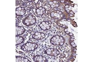 Immunohistochemical staining of human rectum with ZNF235 polyclonal antibody  shows moderate cytoplasmic positivity in glandular cells at 1:50-1:200 dilution. (ZNF235 anticorps)