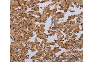 Immunohistochemistry of Human brain  using IFRD1 Polyclonal Antibody at dilution of 1:40