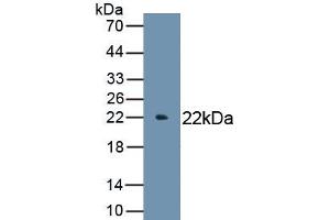 Detection of Recombinant IL6, Chicken using Polyclonal Antibody to Interleukin 6 (IL6)