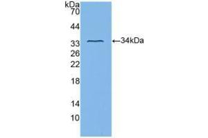 Western blot analysis of recombinant Human ITGb3. (Integrin beta 3 anticorps  (AA 135-377))