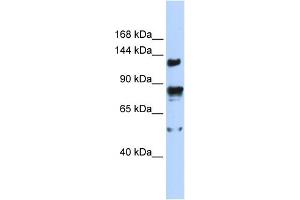 WB Suggested Anti-TRPM4 Antibody Titration:  0. (TRPM4 anticorps  (N-Term))