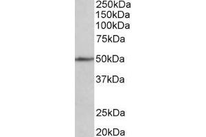 ABIN870695 (1µg/ml) staining of Mouse fetal Heart lysate (35µg protein in RIPA buffer). (CADM1 anticorps  (Internal Region))