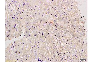 Formalin-fixed and paraffin embedded mouse myocardium labeled with Anti-Myoglobin Polyclonal Antibody, Unconjugated (ABIN704381) at 1:200 followed by conjugation to the secondary antibody and DAB staining.