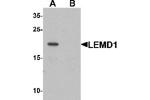Western blot analysis of LEMD1 in A20 cell lysate with LEMD1 antibody at 1 µg/mL in (A) the absence and (B) the presence of blocking peptide. (LEMD1 anticorps  (Middle Region))