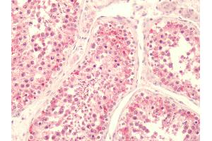 Human, Testis: Formalin-Fixed Paraffin-Embedded (FFPE) (LPAR5 anticorps  (C-Term))