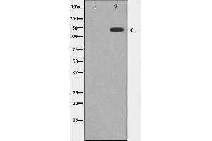 Western blot analysis on HuvEc cell lysate using MEKKK 4 Antibody,The lane on the left is treated with the antigen-specific peptide. (MAP4K4 anticorps  (Internal Region))