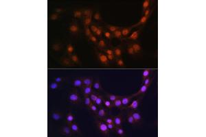 Immunofluorescence analysis of C6 cells using GMFB Rabbit pAb (ABIN6131732, ABIN6141181, ABIN6141182 and ABIN6224741) at dilution of 1:100 (40x lens).