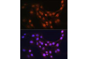 Immunofluorescence analysis of C6 cells using GMFB Rabbit pAb (ABIN6131732, ABIN6141181, ABIN6141182 and ABIN6224741) at dilution of 1:100 (40x lens). (GMFB anticorps  (AA 1-140))