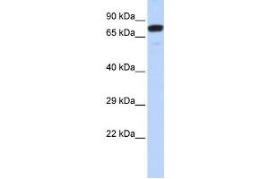 Western Blotting (WB) image for anti-Zinc Finger Protein 221 (ZNF221) antibody (ABIN2458181) (ZNF221 anticorps)