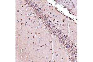 IHC analysis of ORP150/HYOU1 using anti-ORP150/HYOU1 antibody (ABIN7601807).