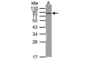 WB Image Sample (50 ug of whole cell lysate)    A: Rat brain   12% SDS PAGE    antibody diluted at 1:1000    