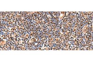 Immunohistochemistry of paraffin-embedded Human tonsil tissue using GPKOW Polyclonal Antibody at dilution of 1:140(x200) (GPKOW anticorps)