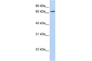 WB Suggested Anti-RNF139 Antibody Titration:  0. (RNF139 anticorps  (N-Term))