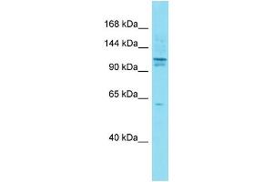 Host:  Rabbit  Target Name:  Axin1  Sample Type:  Mouse Testis lysates  Antibody Dilution:  1. (Axin anticorps  (N-Term))