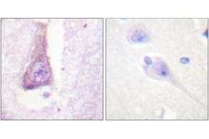Immunohistochemistry analysis of paraffin-embedded human brain tissue, using WASP (Ab-290) Antibody. (WASP anticorps  (AA 256-305))