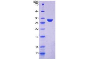 SDS-PAGE analysis of Human Ki-67 Protein. (Ki-67 Protéine)