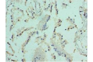 Immunohistochemistry of paraffin-embedded human prostate tissue using ABIN7152098 at dilution of 1:100 (Elf4 anticorps  (AA 1-200))