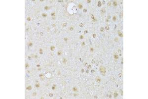 Immunohistochemistry of paraffin-embedded rat brain using HDAC3 Antibody.