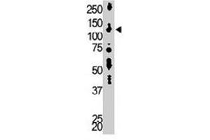 The DGKD polyclonal antibody  is used in Western blot to detect DGKD delta in mouse liver tissue lysate.