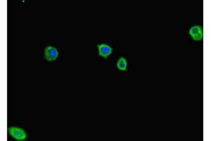 Immunofluorescent analysis of HepG2 cells using ABIN7143320 at dilution of 1:100 and Alexa Fluor 488-congugated AffiniPure Goat Anti-Rabbit IgG(H+L) (ADCY1 anticorps  (AA 416-610))