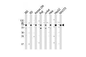 Western Blot at 1:2000 dilution Lane 1: 293 whole cell lysate Lane 2: RD whole cell lysate Lane 3: Karpas 299 whole cell lysate Lane 4: Raji whole cell lysate Lane 5: Jurkat whole cell lysate Lane 6: Hela whole cell lysate Lane 7: HepG2 whole cell lysate Lane 8: NIH/3T3 whole cell lysate Lysates/proteins at 20 ug per lane. (IGF2BP1 anticorps  (C-Term))