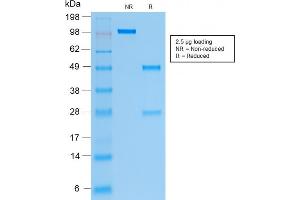 SDS-PAGE Analysis of Purified Cytokeratin 19 Recombinant Mouse Monoclonal Antibody (rKRT19/799).