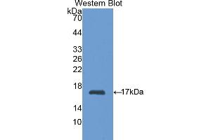 Detection of Recombinant HK1, Rat using Polyclonal Antibody to Hexokinase 1 (HK1) (Hexokinase 1 anticorps  (AA 80-215))