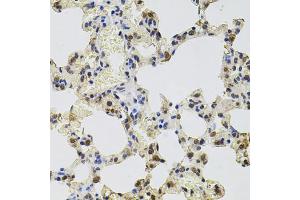 Immunohistochemistry of paraffin-embedded rat lung using GTF2H2 antibody (ABIN5975366) at dilution of 1/100 (40x lens). (GTF2H2 anticorps)