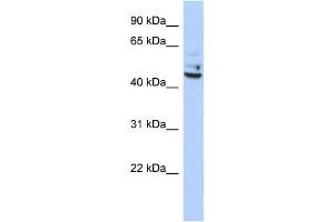 Western Blotting (WB) image for anti-Tumor Protein P53 Inducible Protein 13 (TP53I13) antibody (ABIN2459492)