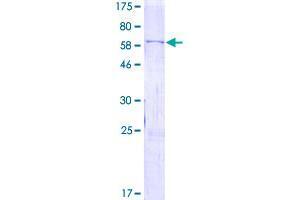 SDS-PAGE (SDS) image for WNT Inhibitory Factor 1 (WIF1) (AA 1-379) protein (GST tag) (ABIN1791464)