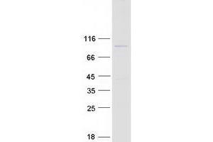 Validation with Western Blot