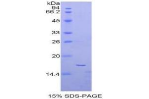 SDS-PAGE of Protein Standard from the Kit (Highly purified E. (alpha Fetoprotein Kit CLIA)