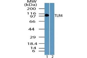 Image no. 1 for anti-Toll-Like Receptor 4 (TLR4) (AA 650-700) antibody (ABIN1491625) (TLR4 anticorps  (AA 650-700))