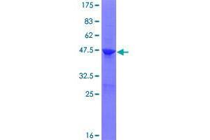 Image no. 1 for ADP-Ribosylation Factor-Like 5B (ARL5B) (AA 1-179) protein (GST tag) (ABIN1345618)