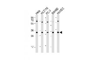 All lanes : Anti-TNFRSF6B Antibody (N-term) at 1:2000 dilution Lane 1: Hela whole cell lysate Lane 2: HC whole cell lysate Lane 3: PC-3 whole cell lysate Lane 4: S whole cell lysate Lane 5: HUVEC whole cell lysate Lysates/proteins at 20 μg per lane. (TNFRSF6B anticorps  (N-Term))