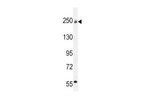 COL5A1 Antibody (N-term) (ABIN654444 and ABIN2844178) western blot analysis in mouse bladder tissue lysates (35 μg/lane).