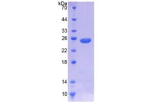 SDS-PAGE analysis of Human NOMO1 Protein. (NOMO1 Protéine)