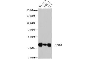 Western blot analysis of extracts of various cell lines, using NPTX2 antibody (ABIN6128350, ABIN6144791, ABIN6144792 and ABIN6215594) at 1:3000 dilution. (NPTX2 anticorps  (AA 90-240))