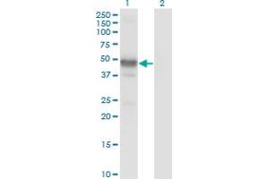 Western Blot analysis of LHX2 expression in transfected 293T cell line by LHX2 monoclonal antibody (M02), clone 1E6.