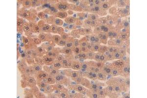 Used in DAB staining on fromalin fixed paraffin- embedded liver tissue