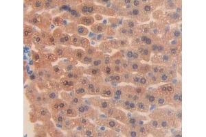Used in DAB staining on fromalin fixed paraffin- embedded liver tissue (ABCF1 anticorps  (AA 617-837))